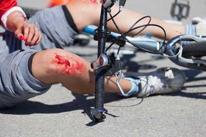 Was passiert bei einem Fahrradunfall ohne Helm?